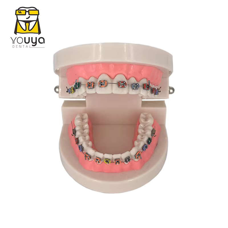 Modèle dentaire avec bretelles, matériaux de dentisterie, modèles orthodontiques, modèle de dents de