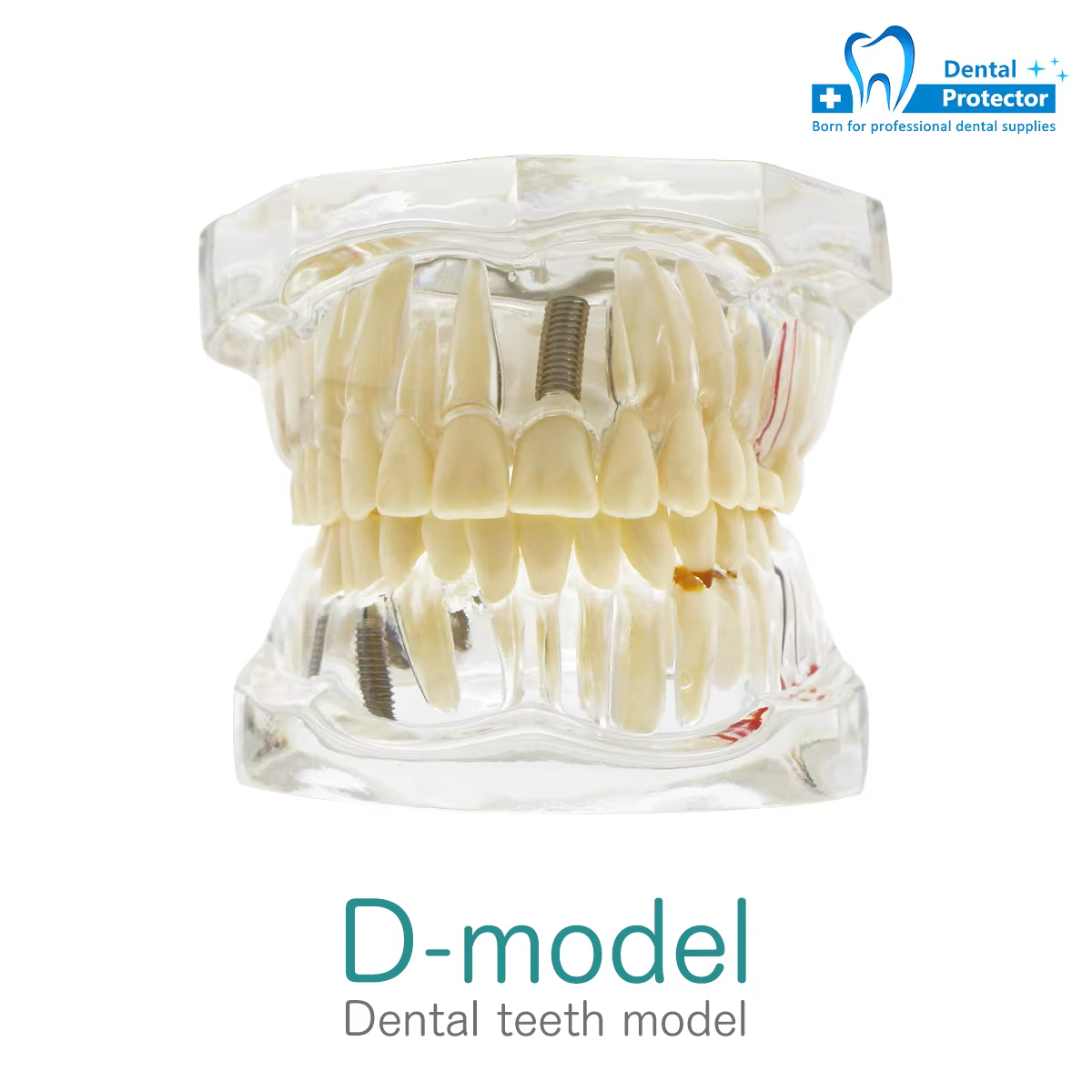 Modèles dentaires modèles amovibles et restaurables des dents maladies pour l'enseignement et la rec